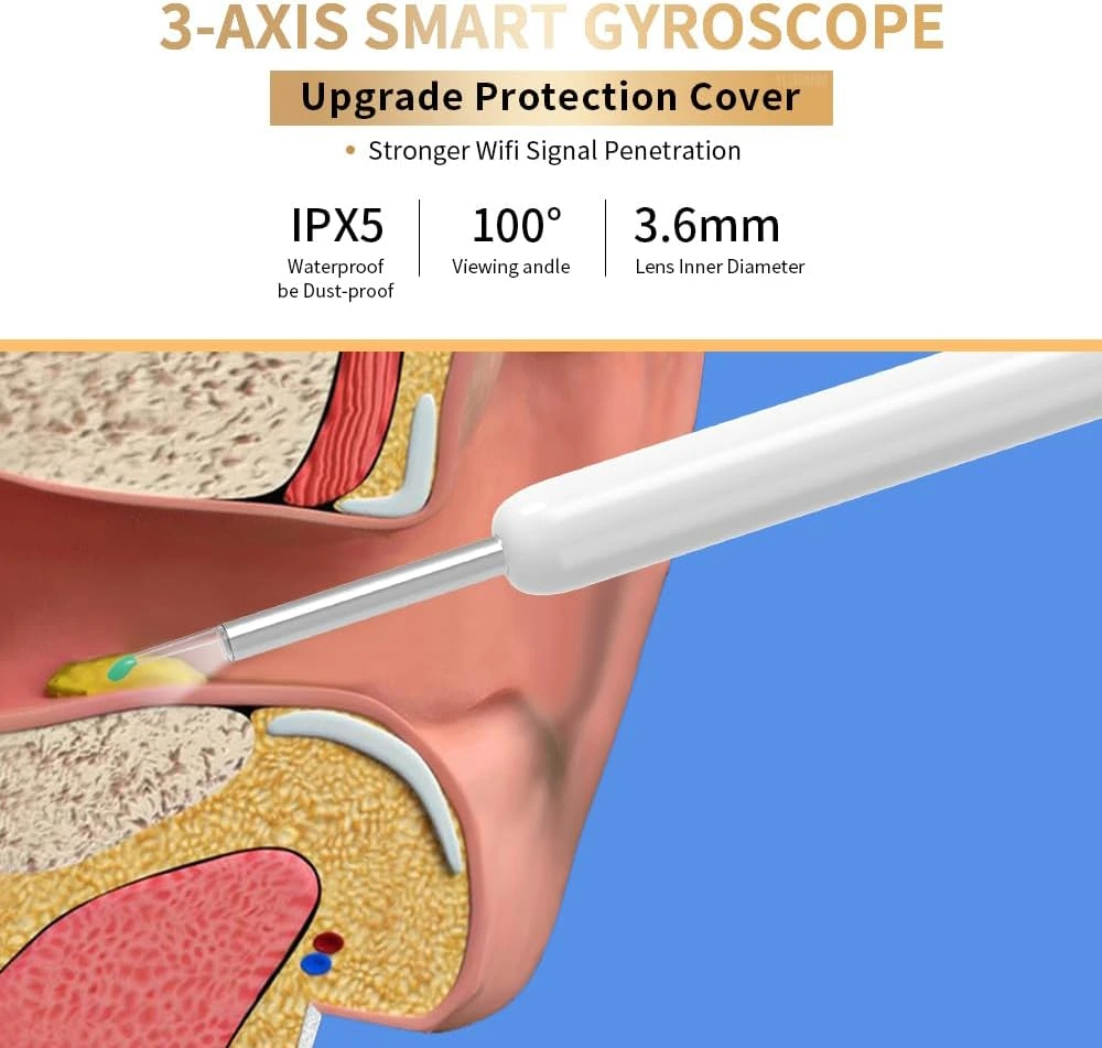 HD Ear Cleaning Camera – ঘরেই কান পরিষ্কার - Image 5